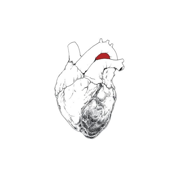 SWANS – BEGGAR LP2